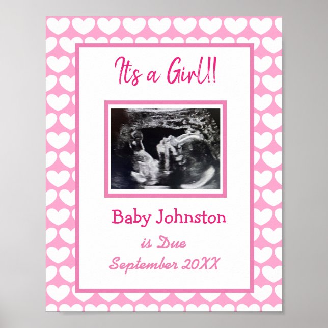 It's a Girl, Pregnancy Announcement Ultrasound Pic Poster (Front)