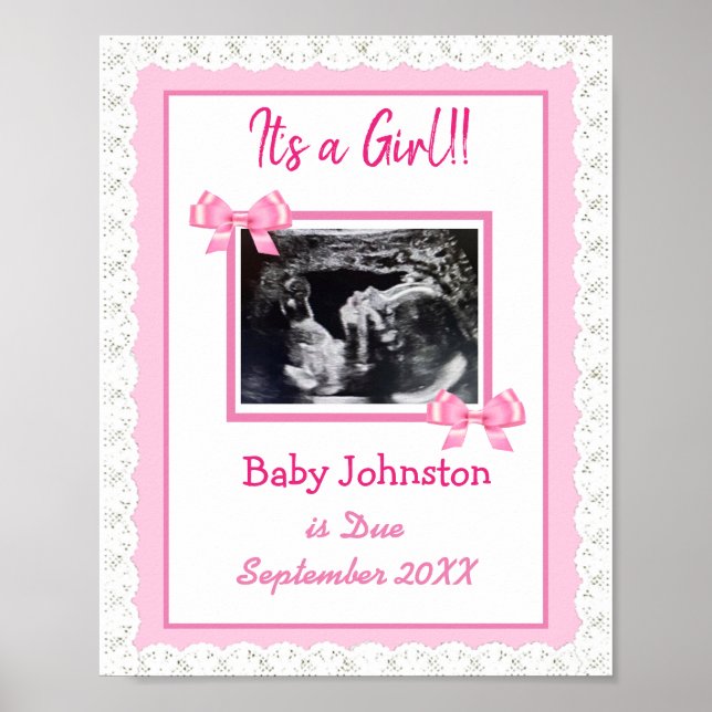 It's a Girl, Pregnancy Announcement Ultrasound Pic Poster (Front)