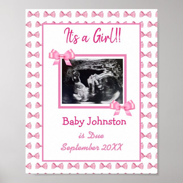 It's a Girl, Pregnancy Announcement Ultrasound Pic Poster (Front)