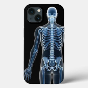 John Doe X-ray iPhone / iPad case