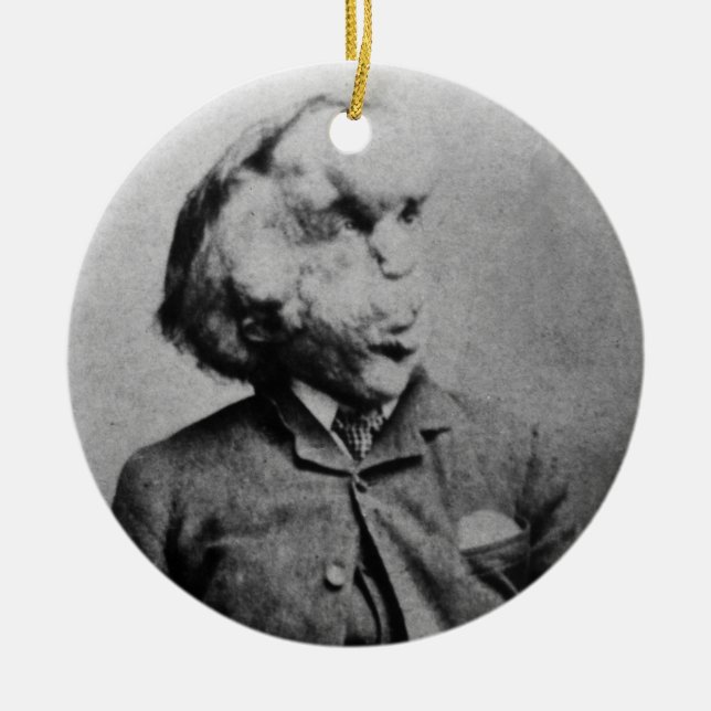 Joseph "John" Merrick The Elephant Man from 1889 Ceramic Tree Decoration (Front)