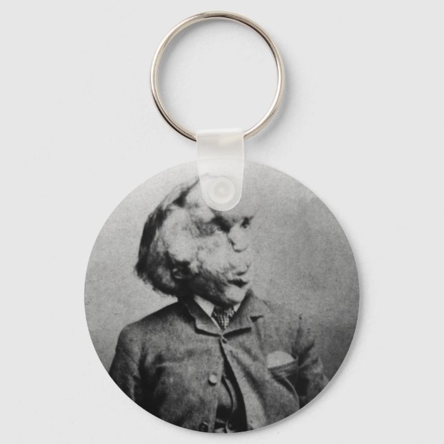 Joseph "John" Merrick The Elephant Man from 1889 Key Ring (Front)