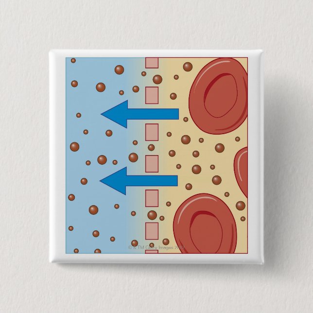 Kidney Dialysis 15 Cm Square Badge (Front)