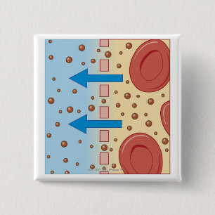 Kidney Dialysis 15 Cm Square Badge