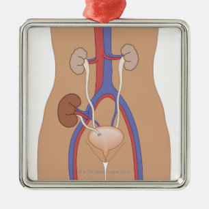 Kidney Transplant Metal Tree Decoration