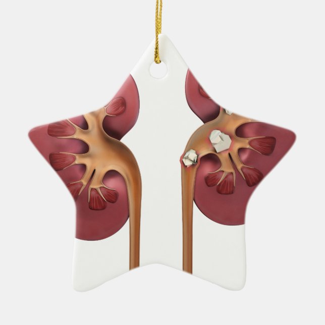 kidneys ceramic tree decoration (Front)