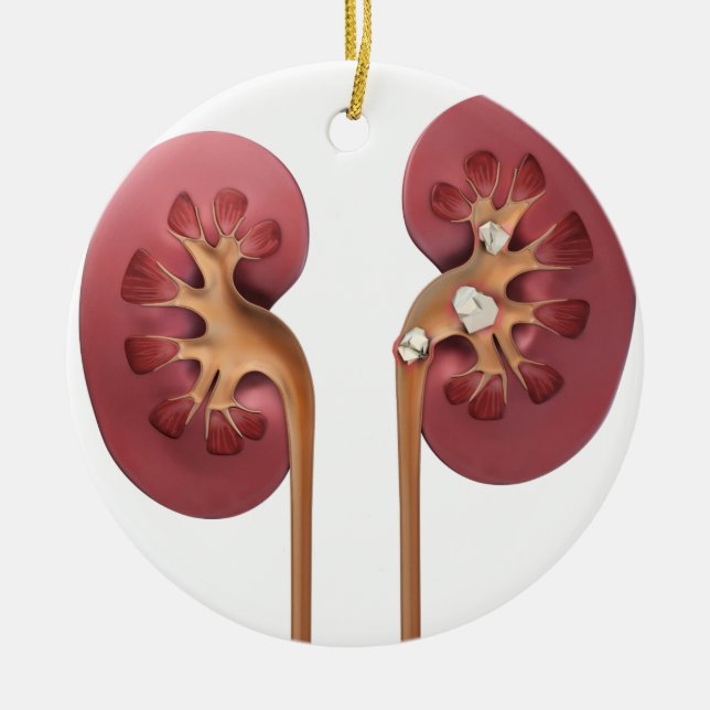 kidneys ceramic tree decoration (Front)