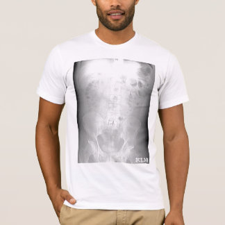 L-5/S1 CT Scan-initialled-by KLM T-Shirt