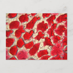 Leaf of a red rose under the microscope postcard