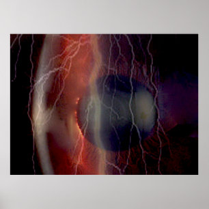Lightning Over a Torn Cornea Poster