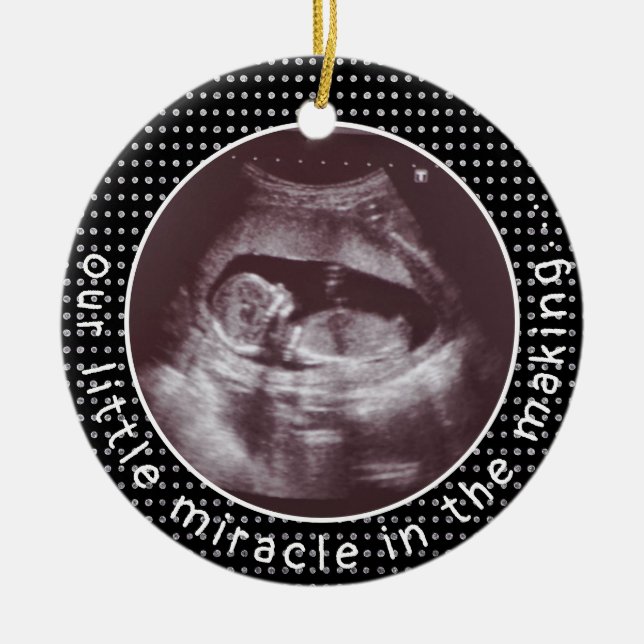 Little Miracle In Making Photo Ultrasound Sonogram Ceramic Ornament (Front)