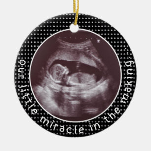 Little Miracle In Making Ultrasound Sonogram Ceramic Ornament