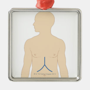 Liver Transplant Metal Tree Decoration