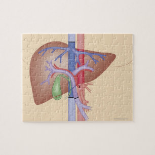 Liver Transplant Procedure Jigsaw Puzzle