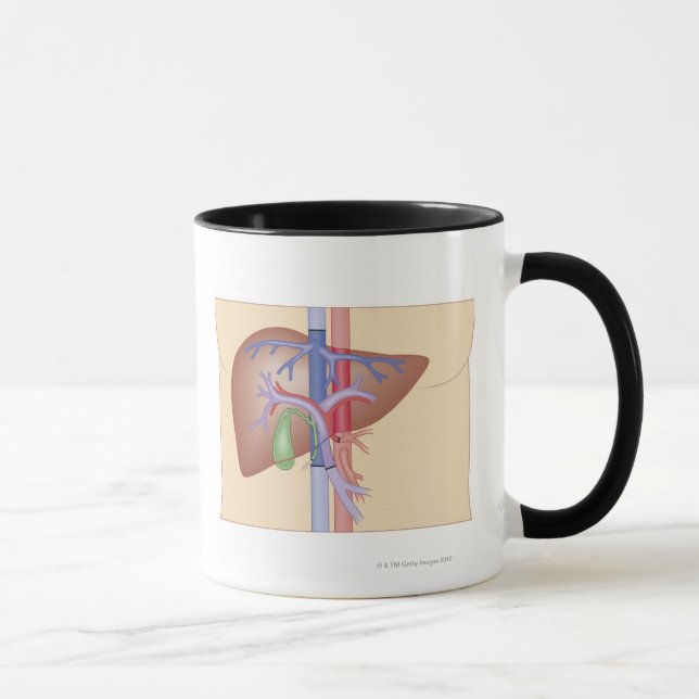 Liver Transplant Procedure Mug (Right)