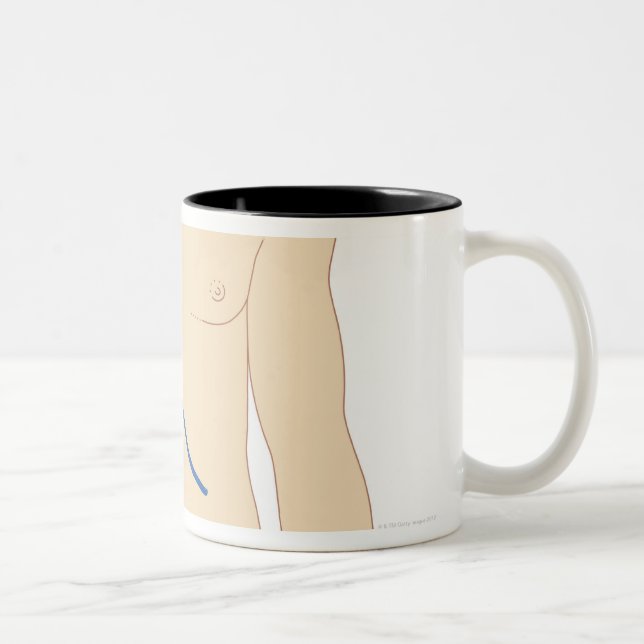Liver Transplant Two-Tone Coffee Mug (Right)