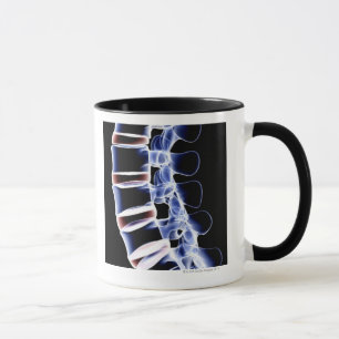 Lumbar Vertebrae 2 Mug