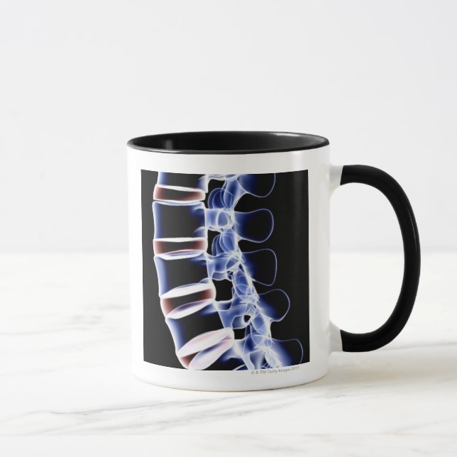 Lumbar Vertebrae 2 Mug (Right)