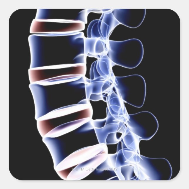 Lumbar Vertebrae 2 Square Sticker (Front)