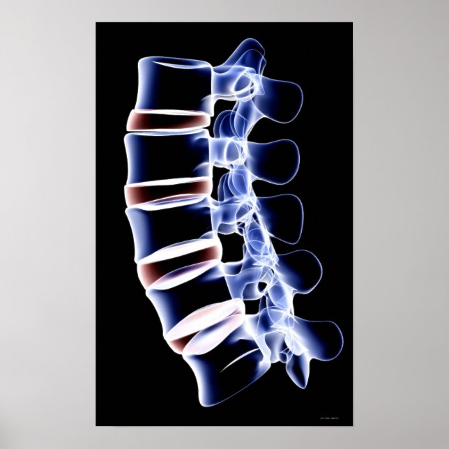 Lumbar Vertebrae Poster (Front)