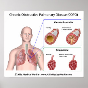 Lung disease COPD labelled Poster