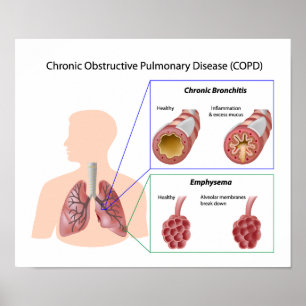 Lung disease (COPD) Poster