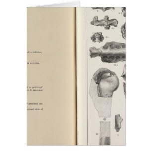 LXVIII Vultur umbrosus