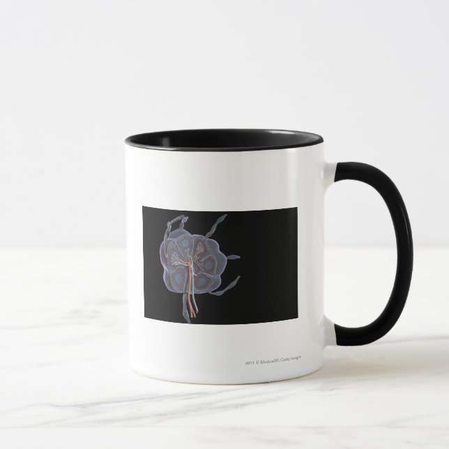 Magnified look of a lymph node mug (Right)