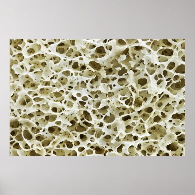 Magnified Porous Texture from the Human Hip Bone Poster (Front)