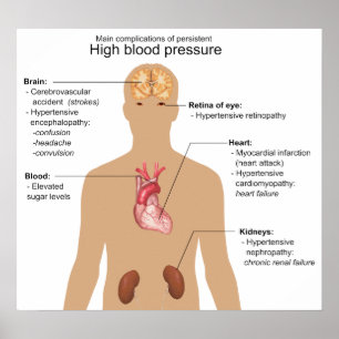 Main Complications of High Blood Pressure Chart