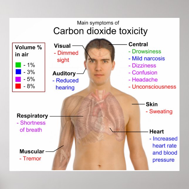 Main Symptoms of Carbon Dioxide Toxicity Chart (Front)