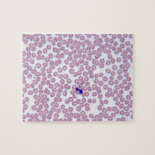 Malarial Blood Cells Jigsaw Puzzle (Horizontal)