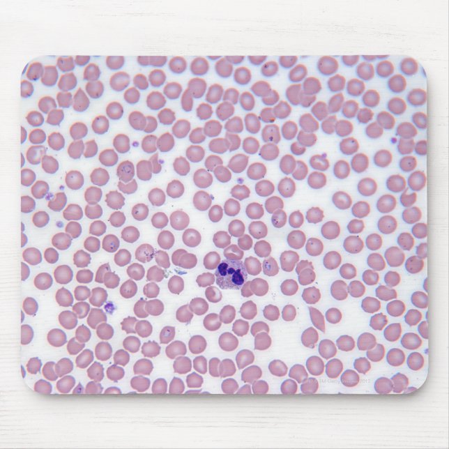 Malarial Blood Cells Mouse Pad (Front)