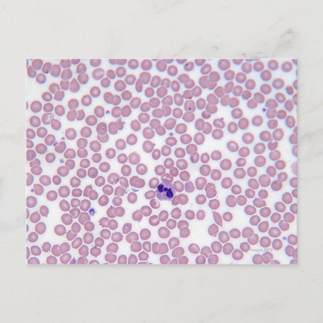 Malarial Blood Cells Postcard (Front)