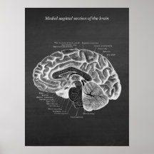Medial Sagittal Section of the Brain print no. 2