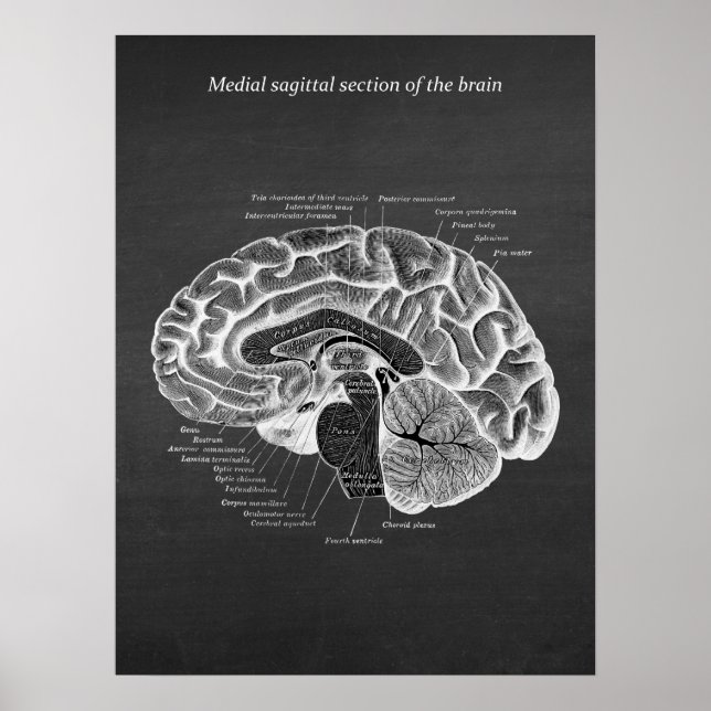 Medial Sagittal Section of the Brain print no. 2 (Front)