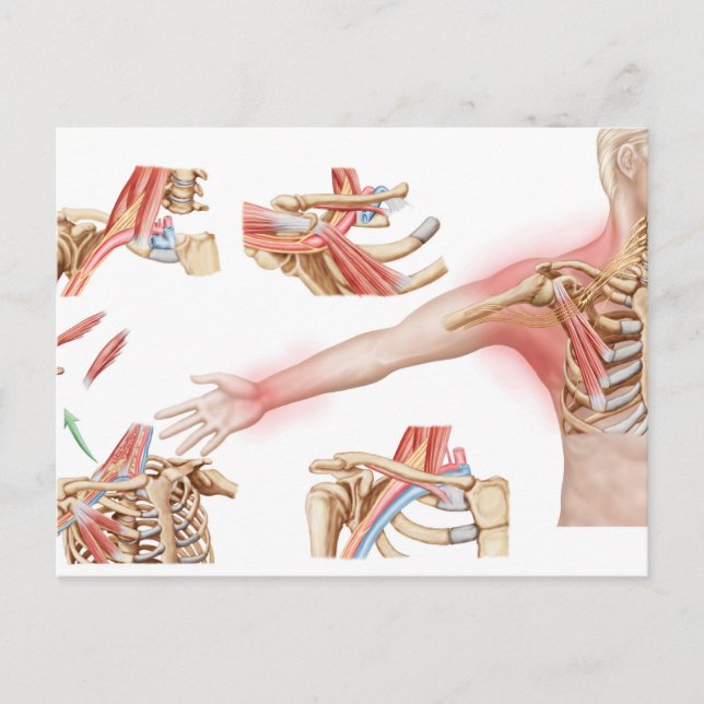 Medical Illustration Detailing Thoracic Outlet Postcard (Front)