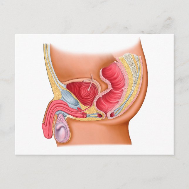 Medical Illustration Of A Rectourethral Fistula Postcard (Front)