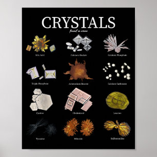 Medical Lab Urine Crystal Laboratory Tech Science Poster