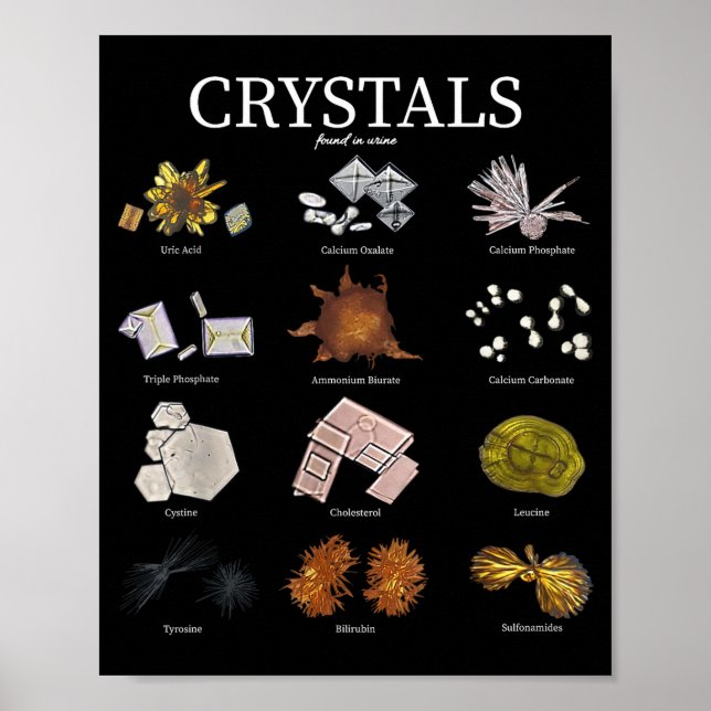 Medical Lab Urine Crystal Laboratory Tech Science  Poster (Front)