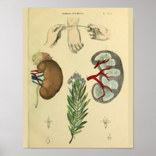Medical Wrist Surgery Kidneys Anatomy Art Print