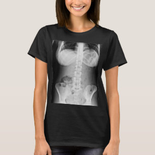 Medical Xray Photo human body anatomy T-Shirt