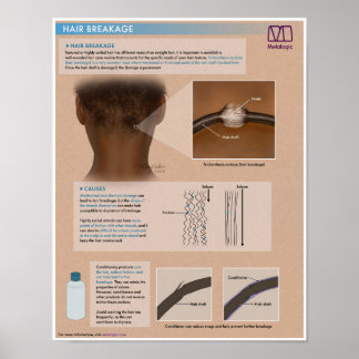 Melalogic Hair Breakage Medical Poster