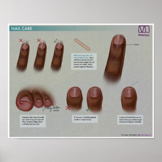 Melalogic Nail Care Medical Poster