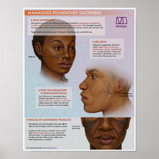 Melalogic Skin Lightening Medical Poster