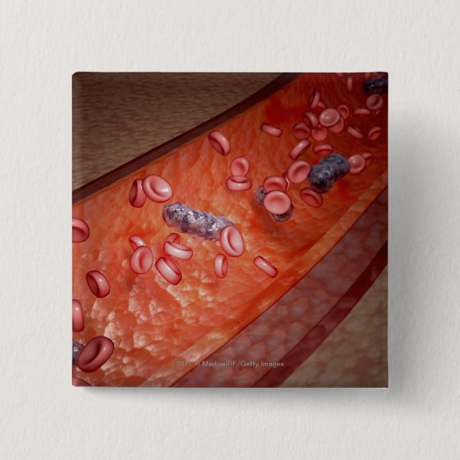 Microscopic rendering of a blood infection 15 cm square badge (Front)