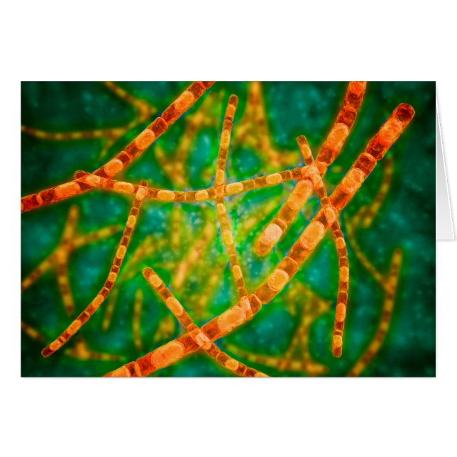 Microscopic View Of Anthrax 2 (Front Horizontal)