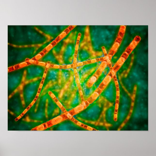 Microscopic View Of Anthrax 2 Poster (Front)