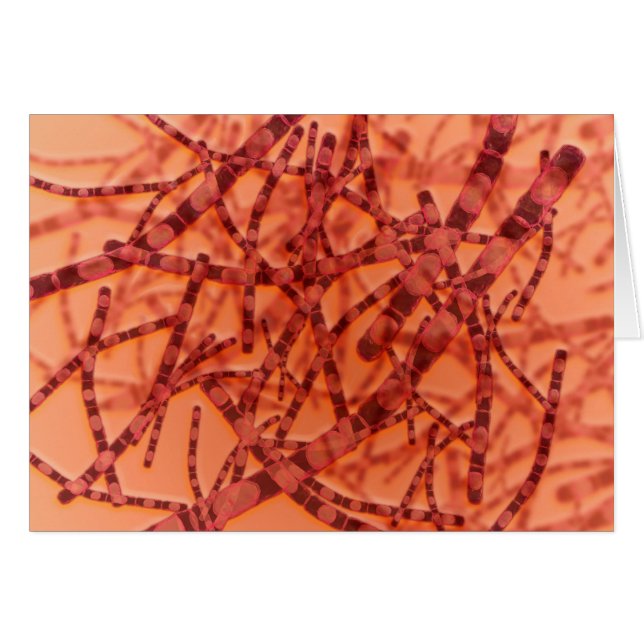 Microscopic View Of Anthrax 3 (Front Horizontal)