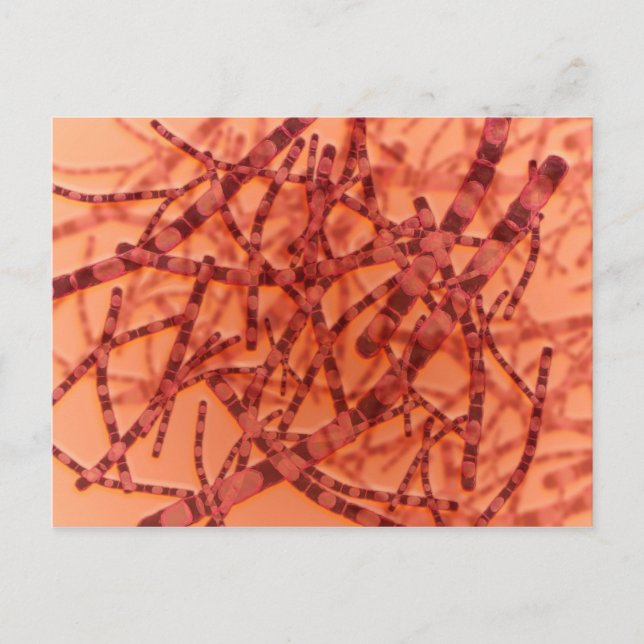 Microscopic View Of Anthrax 3 Postcard (Front)